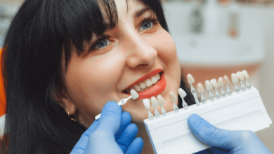 Top Cosmetic Dentistry Trends for 2024