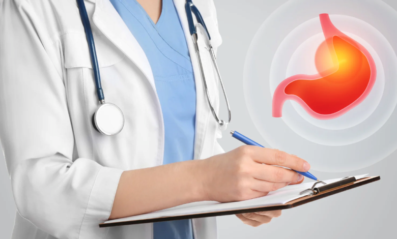 Common Myths in Gastroesophageal Reflux Disease (GERD)