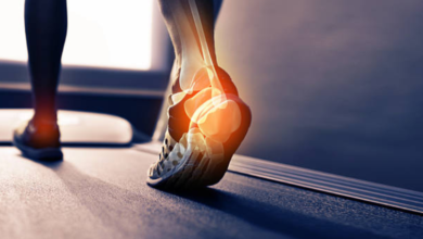 Heel Spurs vs. Plantar Fasciitis: Understanding the Difference to Get the Right Treatment