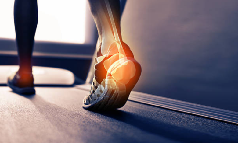 Heel Spurs vs. Plantar Fasciitis: Understanding the Difference to Get the Right Treatment