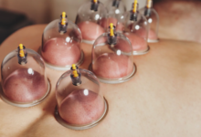 Boosting Circulation and Detoxification Through Professional Cupping Sessions