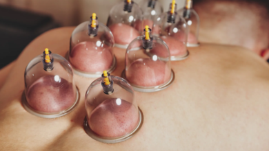 Boosting Circulation and Detoxification Through Professional Cupping Sessions